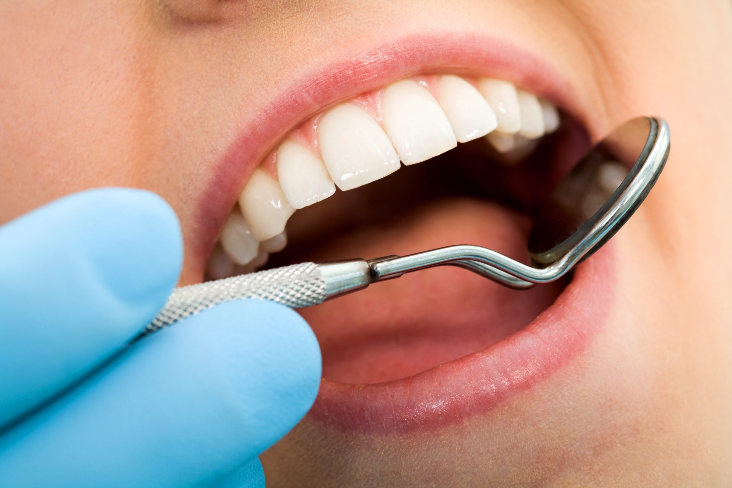 amalgams holistic dentist mercury