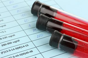 iron_ferritin_breastcancer