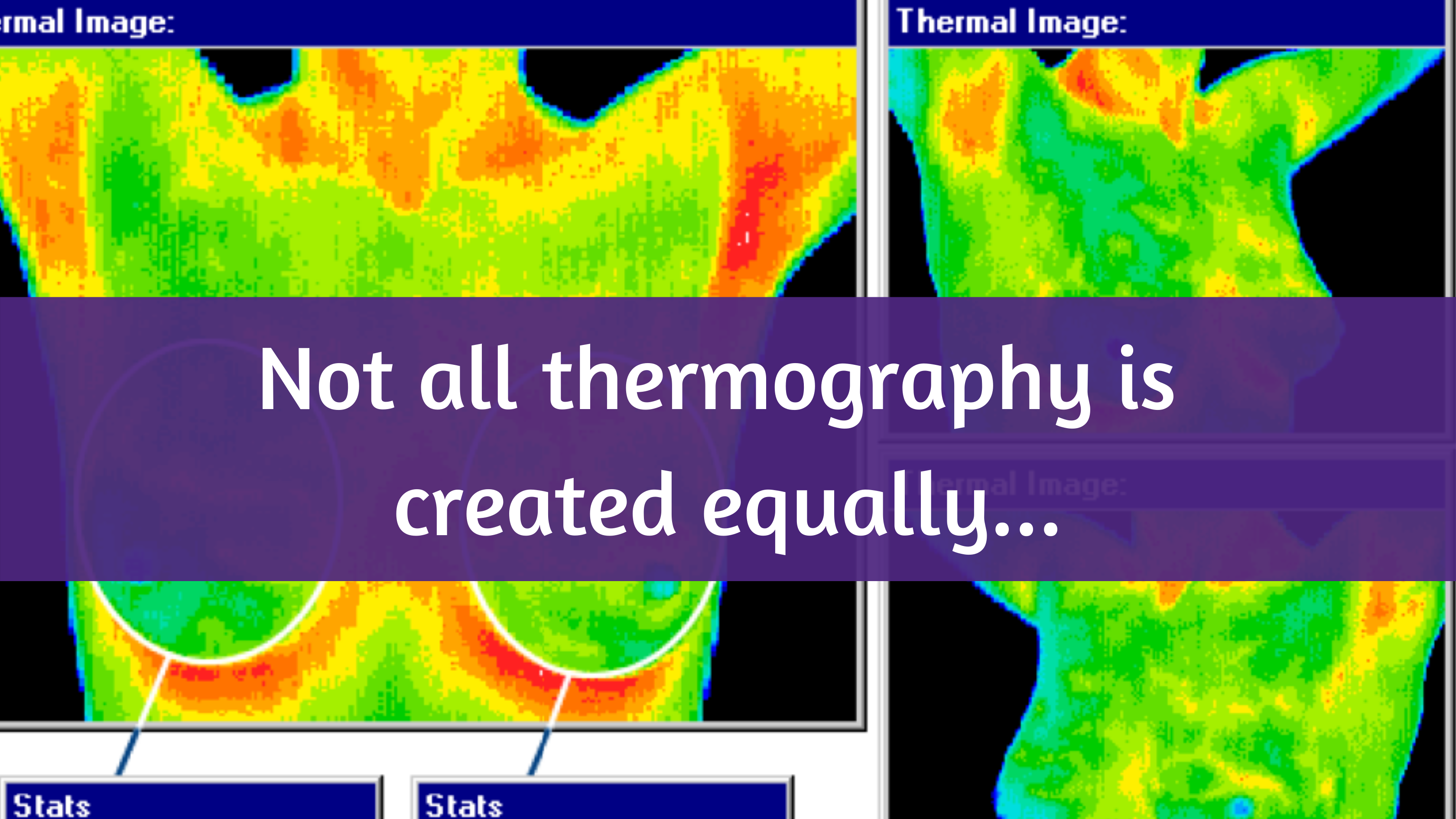 Thermography Feature Breast Cancer Conqueror