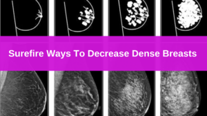 surefire ways to decrease dense breasts