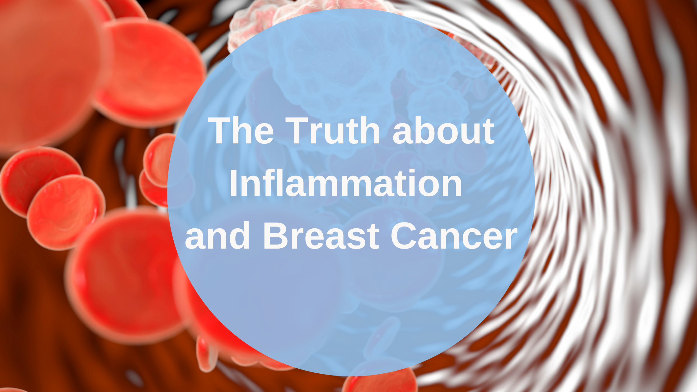 Inflammation and breast cancer