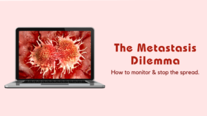 The Metastasis Dilemma: How to monitor and stop the spread.