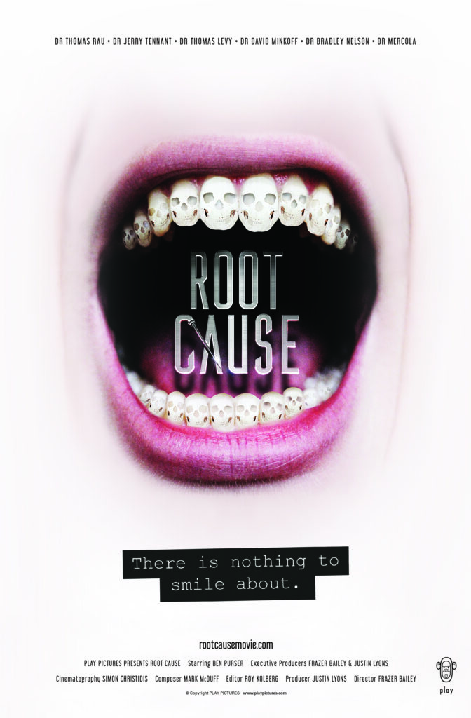 Root Cause Documentary 