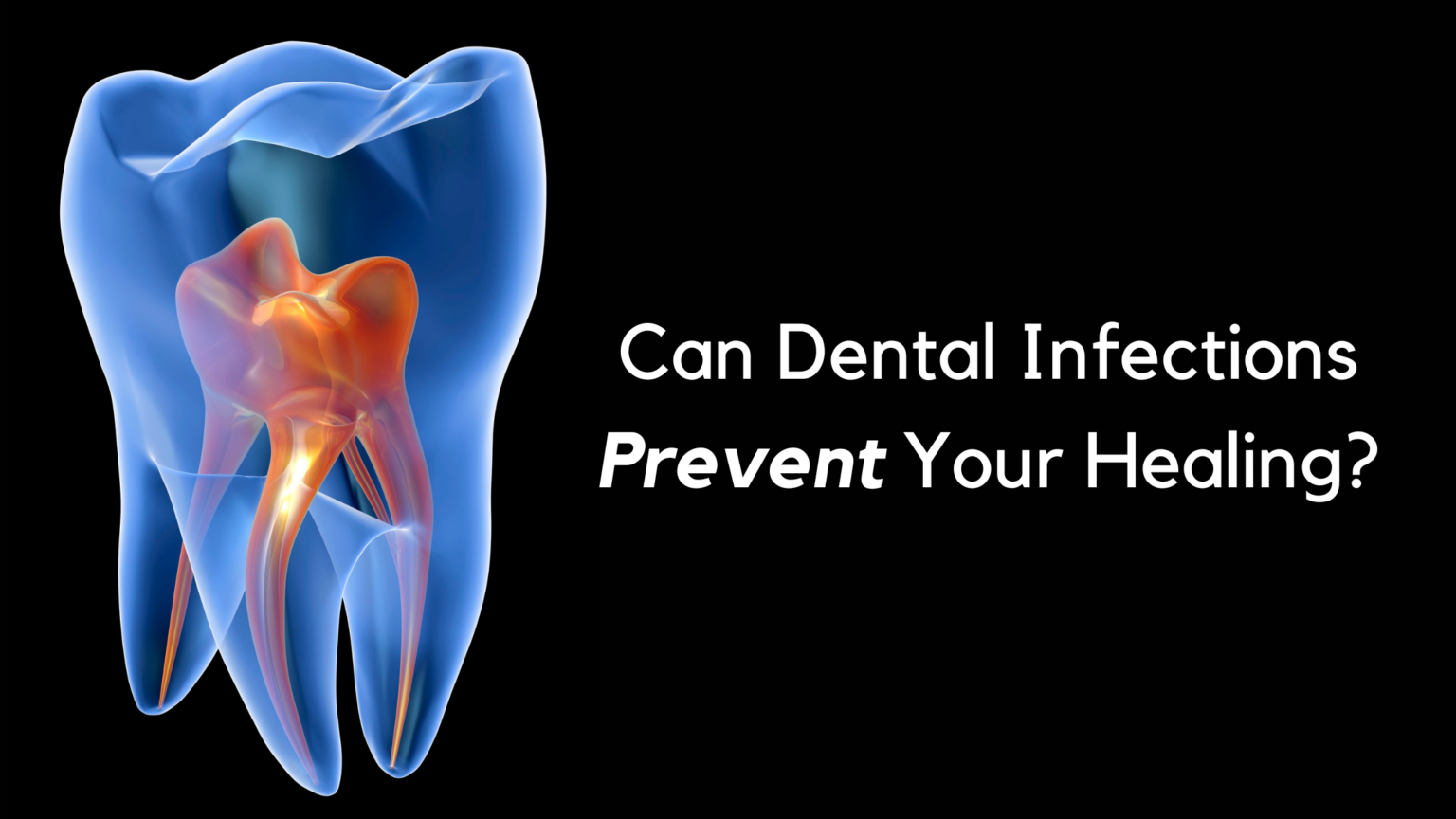 Can Dental Infections Prevent Your Healing? - Breast Cancer Conqueror