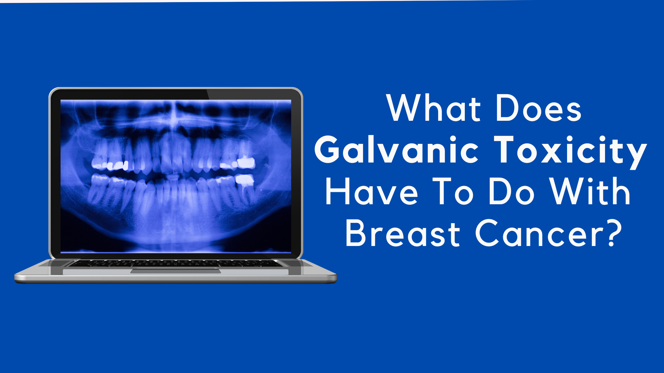 What Does Galvanic Toxicity Have To Do With Breast Cancer?