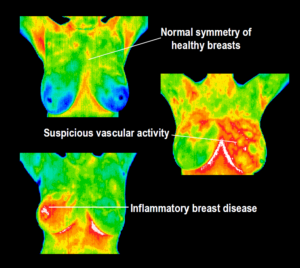 BHAM! Why Thermography Just Makes Sense