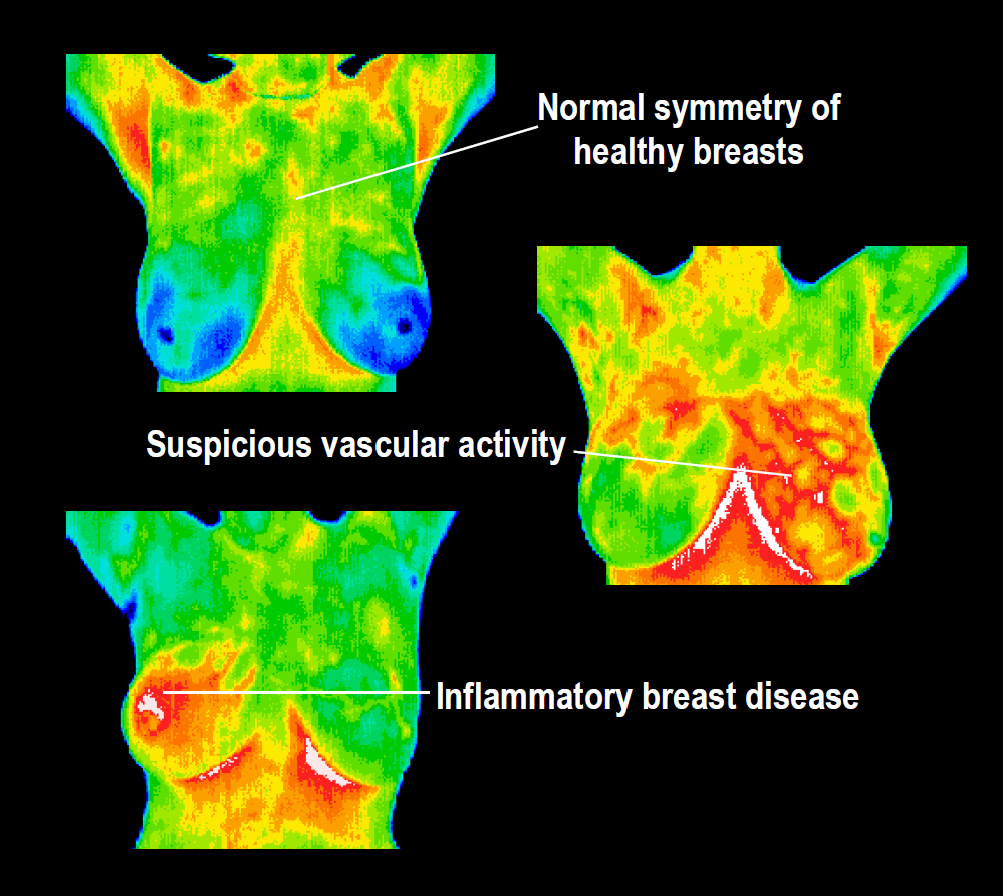 BHAM! Why Thermography Just Makes Sense