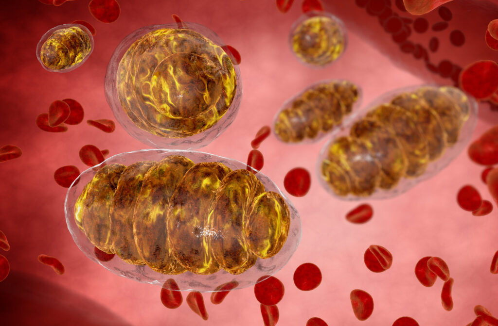 The New Theory About Cancer – It’s a Metabolic Dis-ease