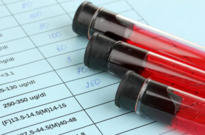 iron_ferritin_breastcancer