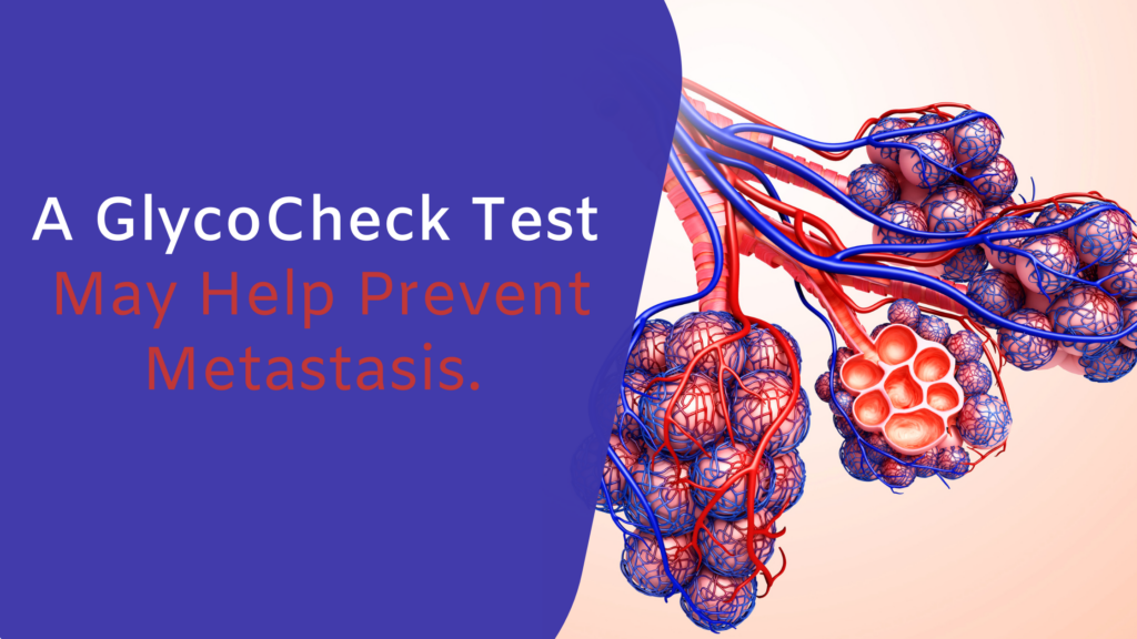 A GlycoCheck Test May Help Prevent Metastasis