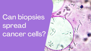 Can A Biopsy Spread Cancer Cells?