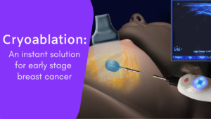 Cryoablation – An Alternative to Surgery?