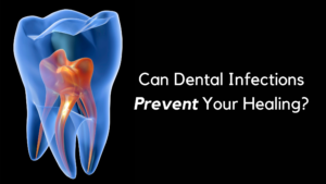 Can Dental Infections Prevent Your Healing?